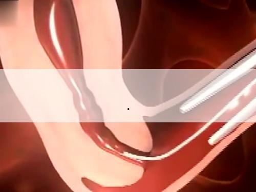 孕妇怀孕初期感冒,孕妇怀孕初期感冒了怎么办呢