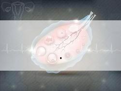 孕妇 健身,孕妇健身操